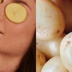 quitar-las-ojeras-con-papa