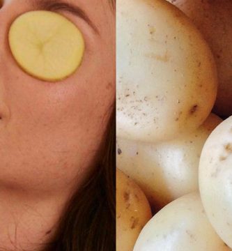 quitar-las-ojeras-con-papa