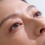 cirugia-de-parpados--blefaroplastia-rostro-femenino-relajado