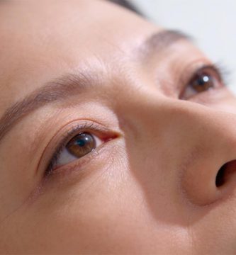 cirugia-de-parpados--blefaroplastia-rostro-femenino-relajado