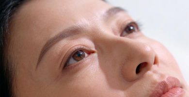 cirugia-de-parpados--blefaroplastia-rostro-femenino-relajado